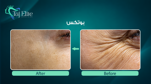 before-^-after21